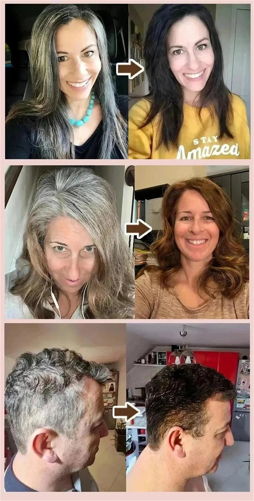 Gray White Hair Treatment Serum Spray Cover White Hair To Black Natural Color Repair Anti Loss Hair Restore Healthy Hair Care