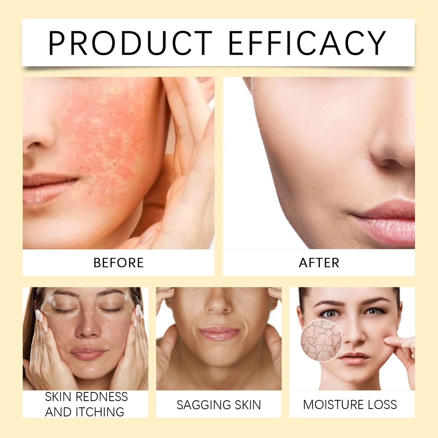 Bee Venom Skin Care Serum Cream Relieve Dry Skin Nourishing Skin Elastic Moisturizing Tightening Smoothing Brightening Cream