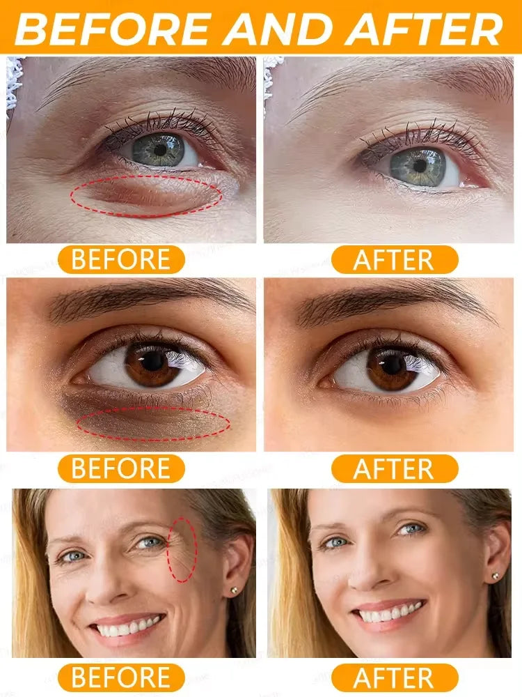 Instant Eye Bag Removal Cream Retinol Anti-Wrinkle Firming Skin Fade Fine Lines Anti Dark Circle Puffiness Brighten Eye Care Gel