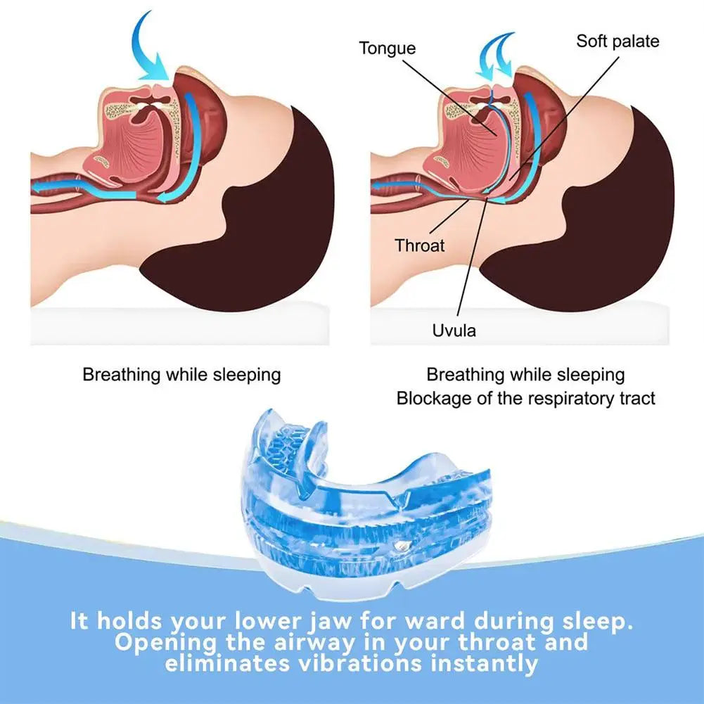 Anti Snoring Mouth Guard Adjustable Anti-Snoring Mouthpiece Sleeping Devices Bruxism Snoring Stopper Improve Sleep Mouthpiece