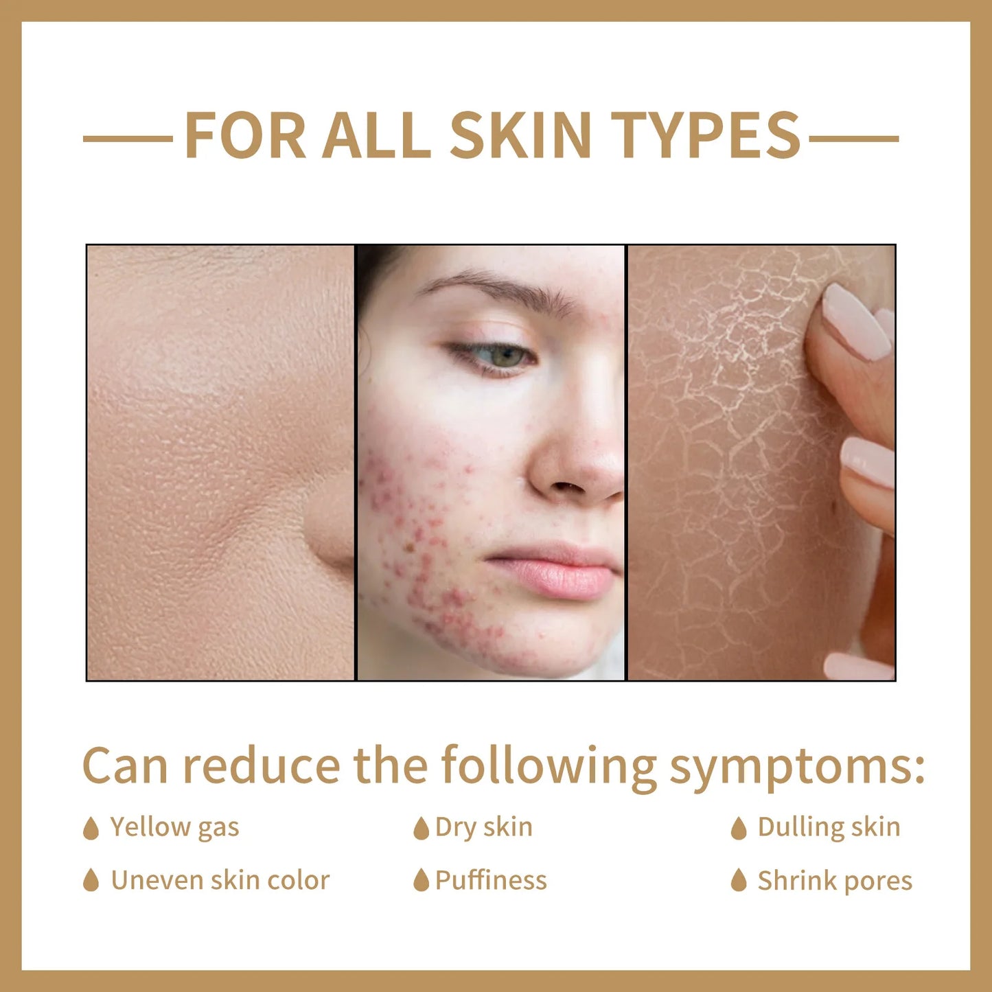 EELHOE Rice Toner Moisturizing Water Oil Control Smoothing Facial Wrinkles Shrink Pores Repair Skin Care Rice Water Toner 150ml