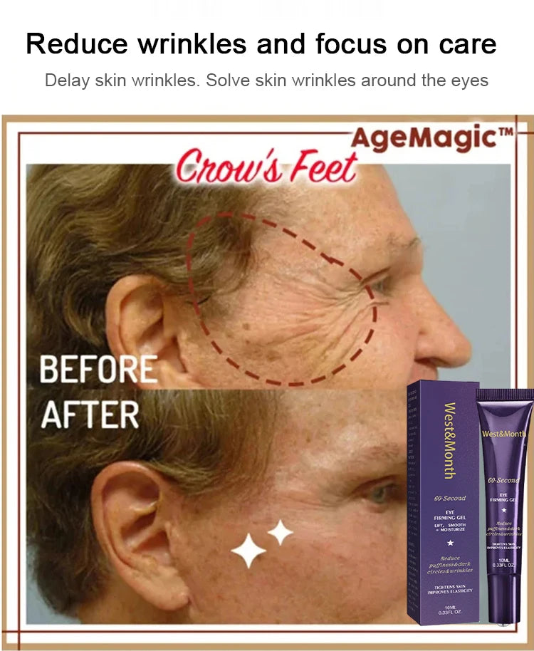 Instant Eye Bag Removal Cream Retinol Anti-Wrinkle Firming Skin Fade Fine Lines Anti Dark Circle Puffiness Brighten Eye Care Gel