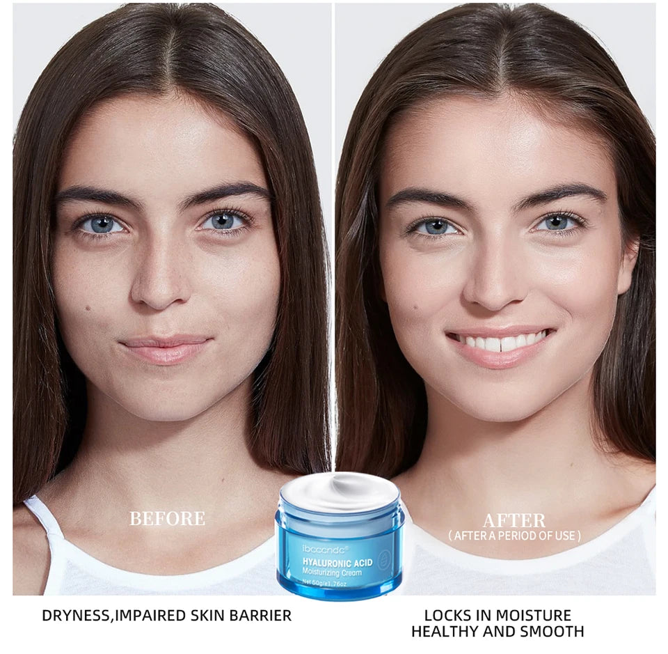 Hydro Boost Face Moisturizer with Hyaluronic Acid for Dry Skin Oil-Free and Non-Comedogenic Water Gel Face Lotion