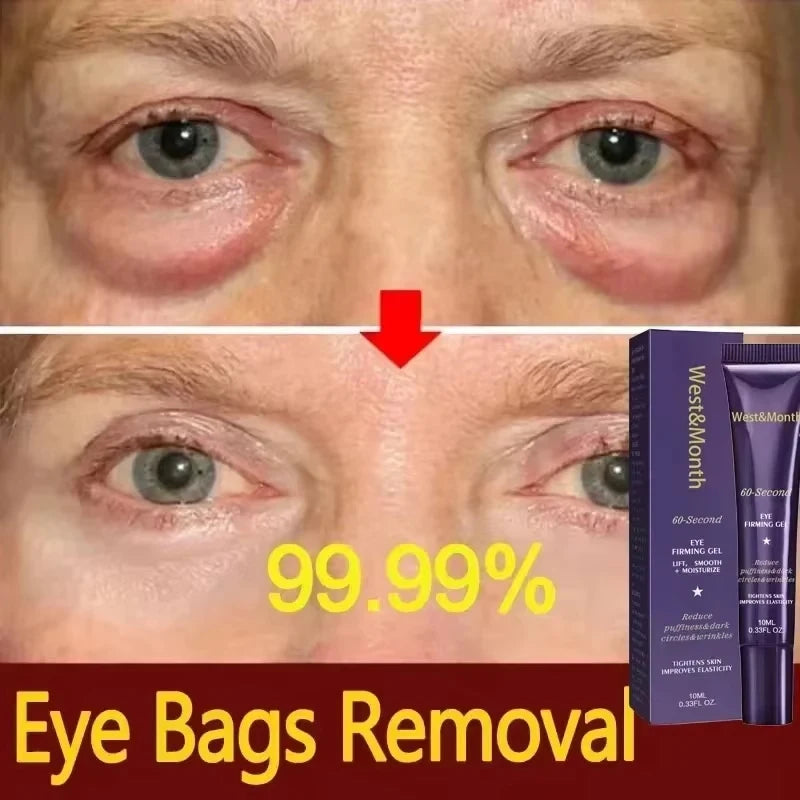 Instant Eye Bag Removal Cream Retinol Anti-Wrinkle Firming Skin Fade Fine Lines Anti Dark Circle Puffiness Brighten Eye Care Gel