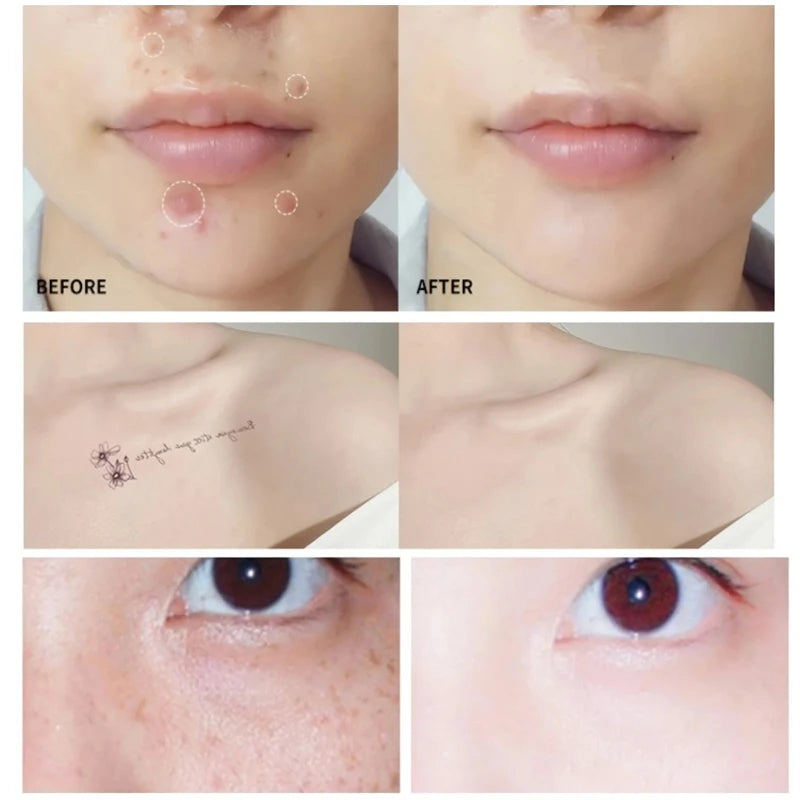 High Coverage Concealer Corrector Anti Dark Circle Freckle Lasting Matte Foundation Skin Corrector Face Makeup Base Cosmetics