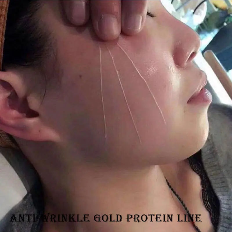 5Bags/60Pcs Absorbable Anti-wrinkle Face Filler Women Beauty Care Skin Collagen Based Protein Thread Gold Protein Line Skin Care