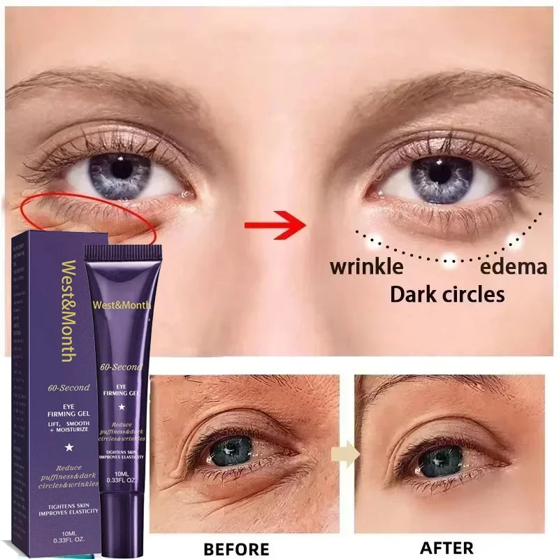 Instant Eye Bag Removal Cream Retinol Anti-Wrinkle Firming Skin Fade Fine Lines Anti Dark Circle Puffiness Brighten Eye Care Gel